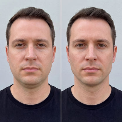 Jawline Compression Wrap